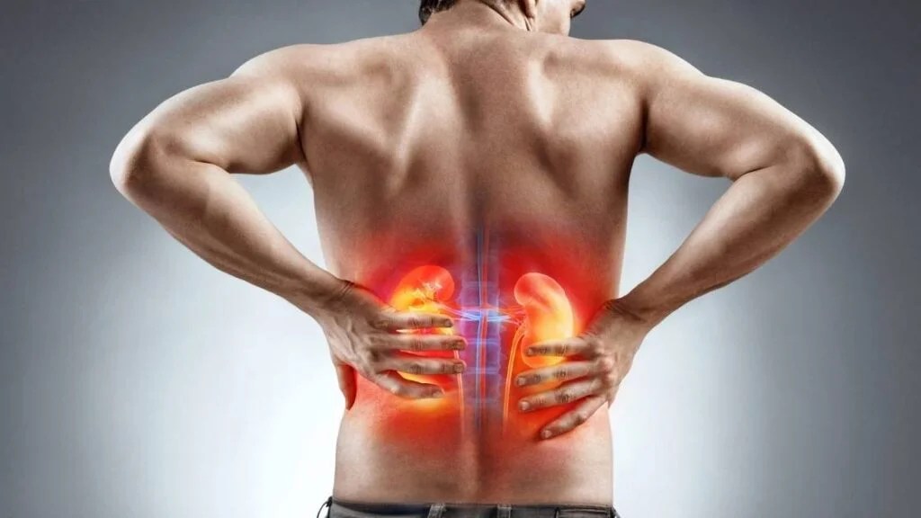 Calor intenso e rotina corrida acendem alerta para a saúde dos rins; saiba como prevenir a desidratação e o cálculo&nbsp;renal.